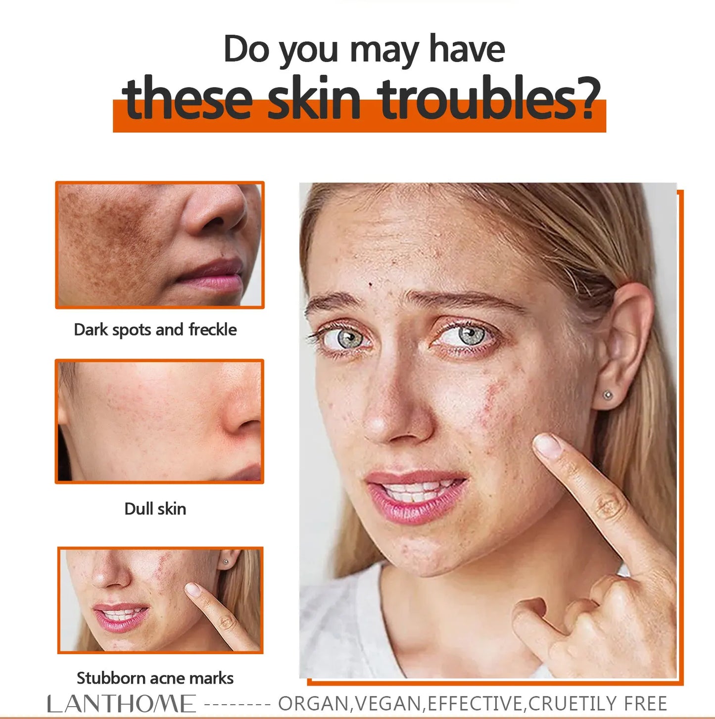 Savon Kojic anti-taches Lanthome