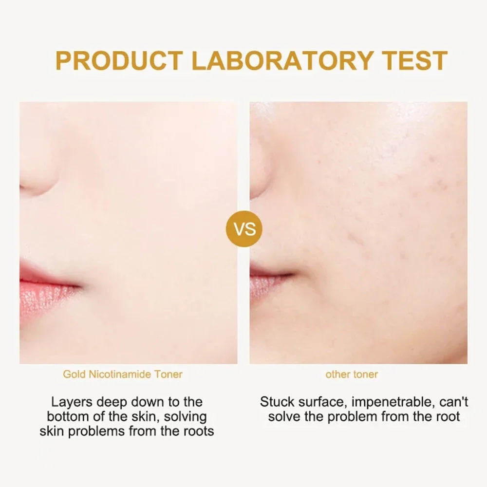 Gold Nicotinamide Toner Moisturize Oil