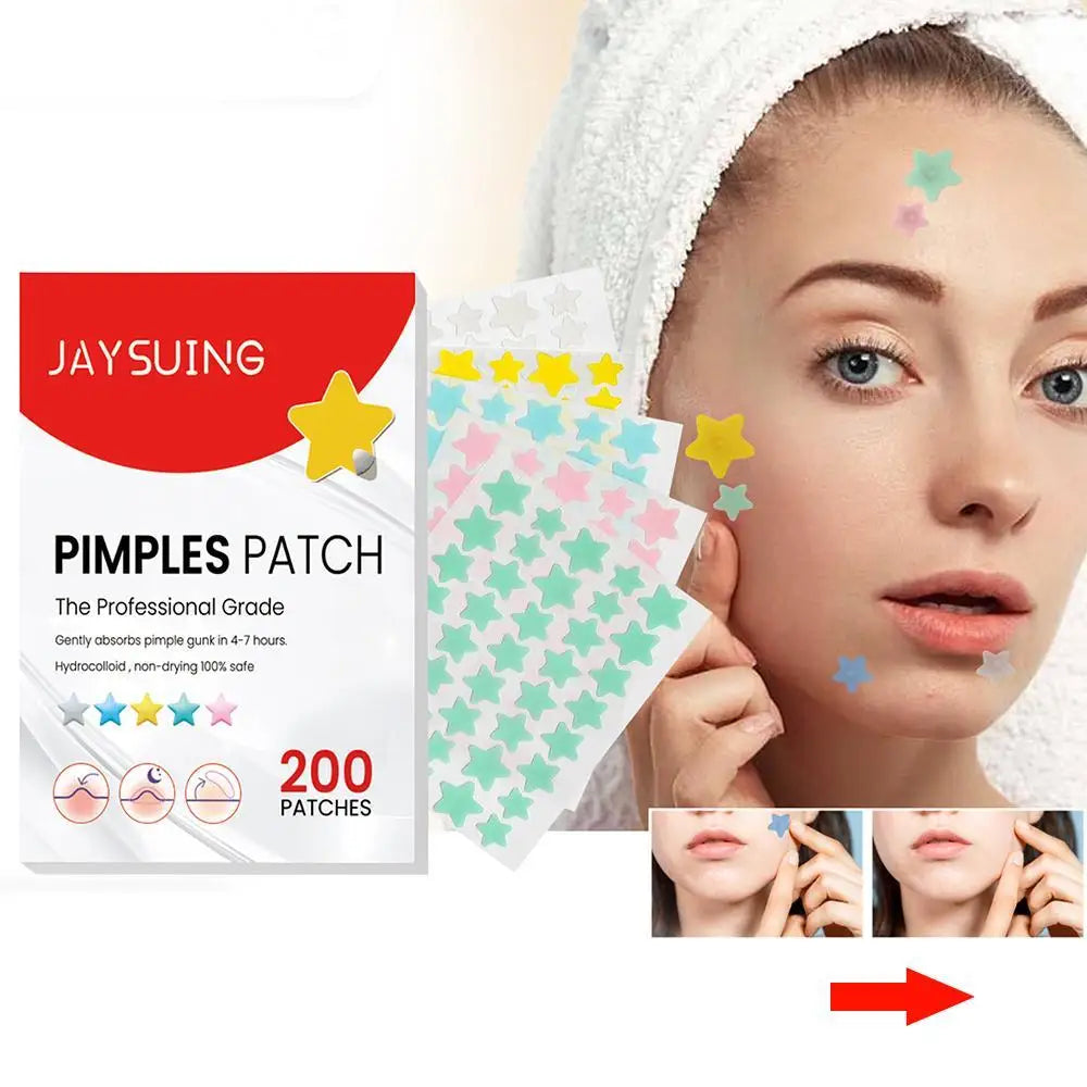 start pimple patches
