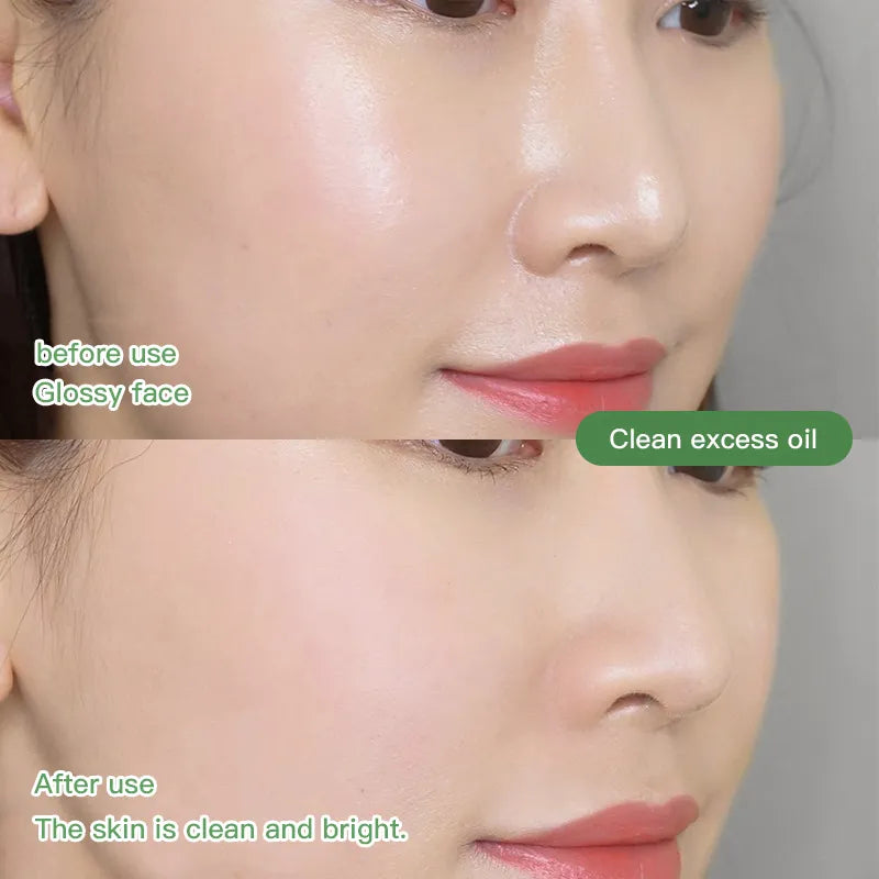Deep Pore Cleansing Mud Stick Blackhead Removal