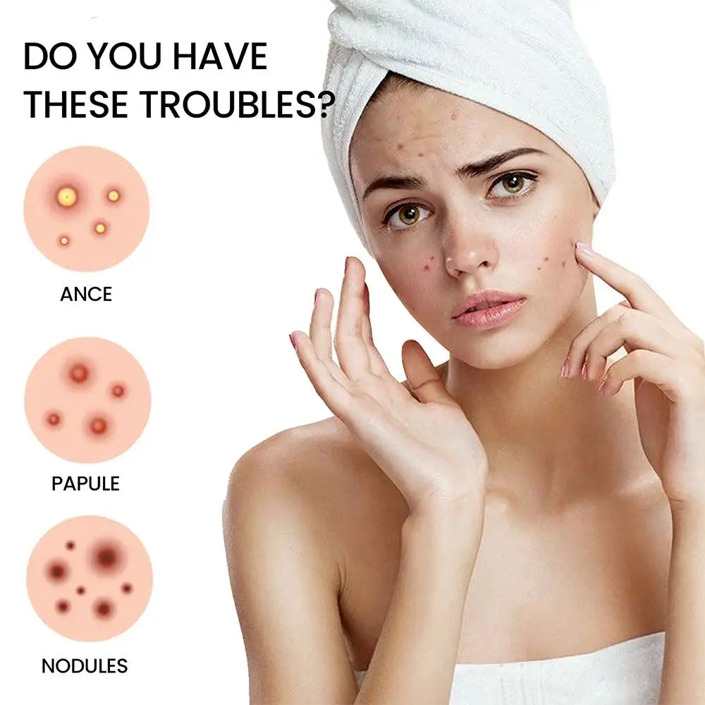 start pimple patches