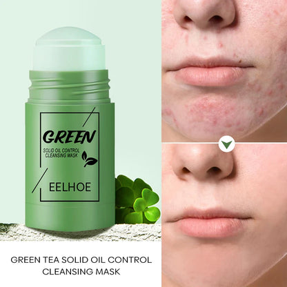 Traitement de l'acné au masque au thé vert