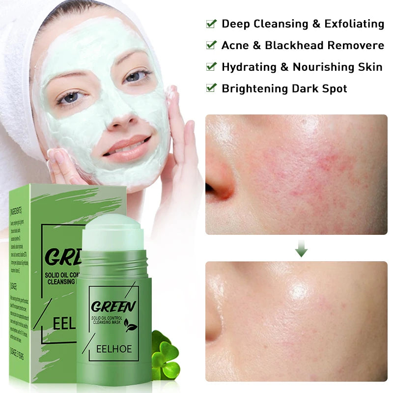 Green Tea Mask Acne Treatment