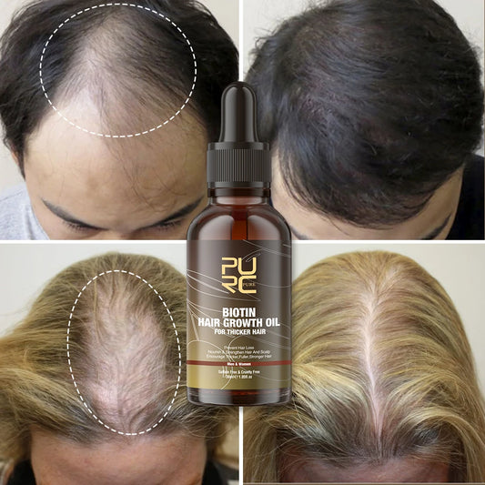 Shampooing à la biotine Croissance rapide et prévention de la chute des cheveux