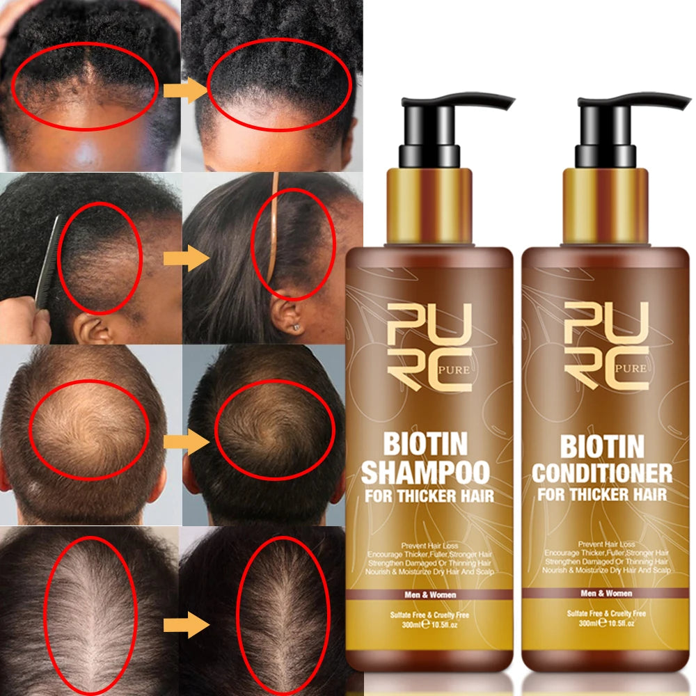 Shampooing à la biotine Croissance rapide et prévention de la chute des cheveux