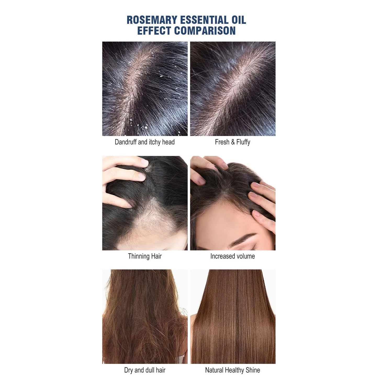 Rosemary Oil for Hair Growth – Biotin-Infused Hair Strengthening & Nourishing Treatment