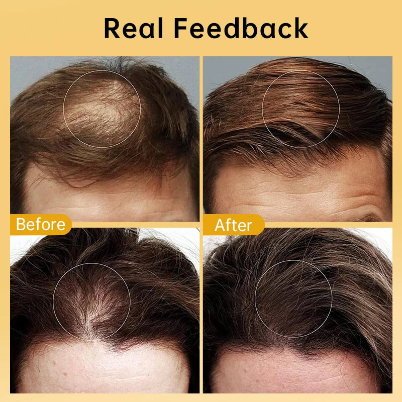 oil scalp for hair growth