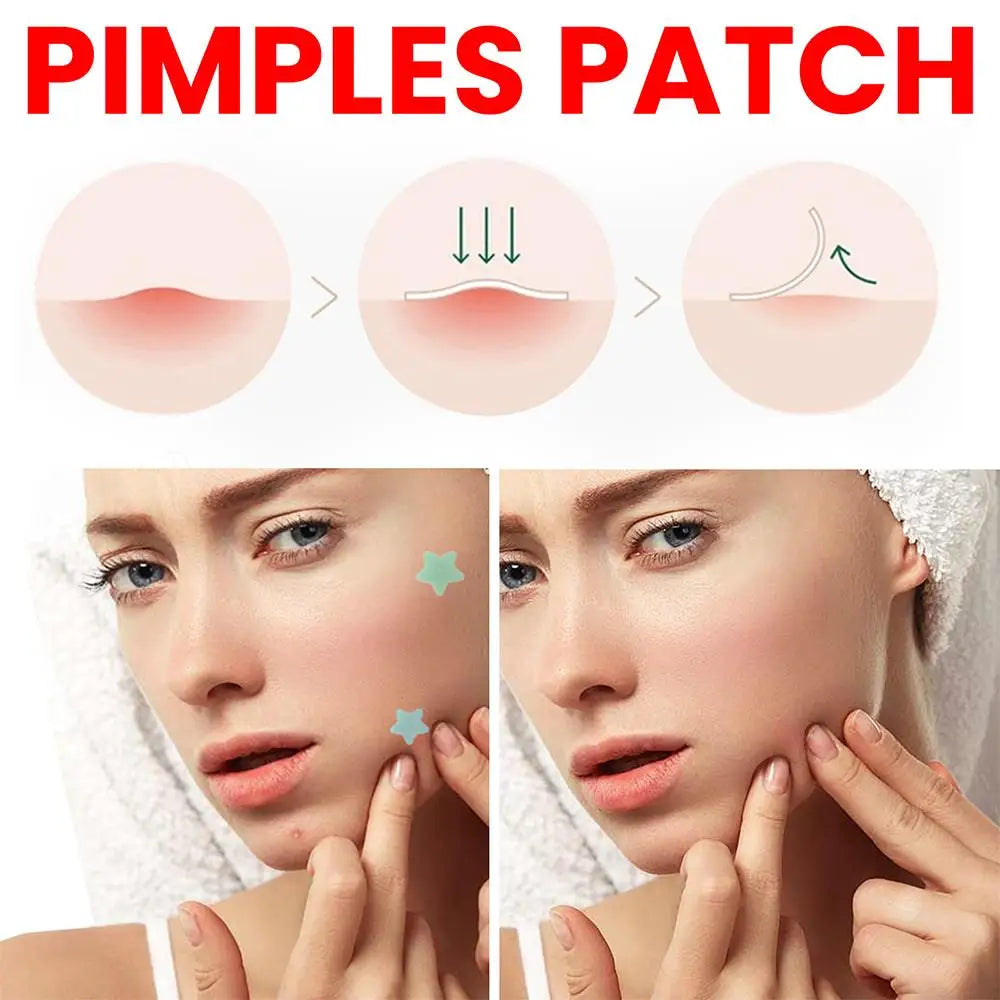 start pimple patches
