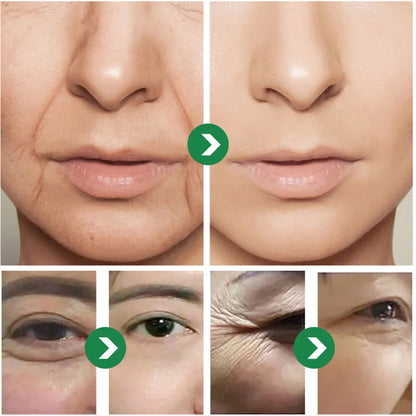 Japanese Six Peptides Face & Neck Anti-Wrinkle Cream